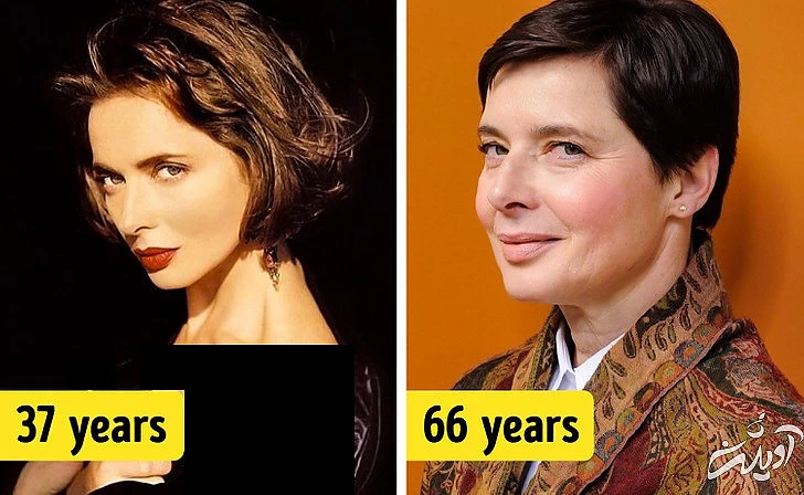 چهرههای معروفی که هیچ جراحی زیبایی نکردهاند